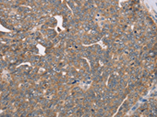 Rabbit Polyclonal Antibody to FAIM2