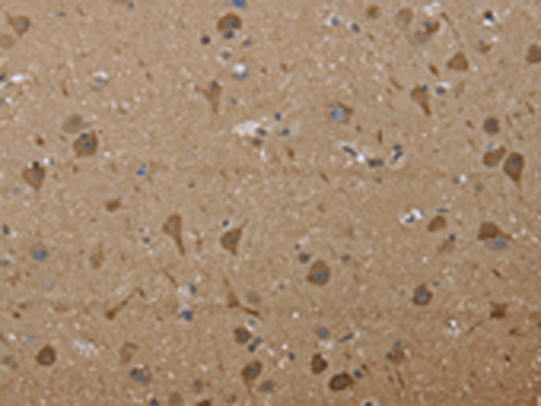 Rabbit Polyclonal Antibody to PTK2B