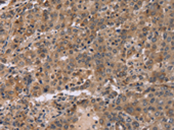Rabbit Polyclonal Antibody to FAM107A