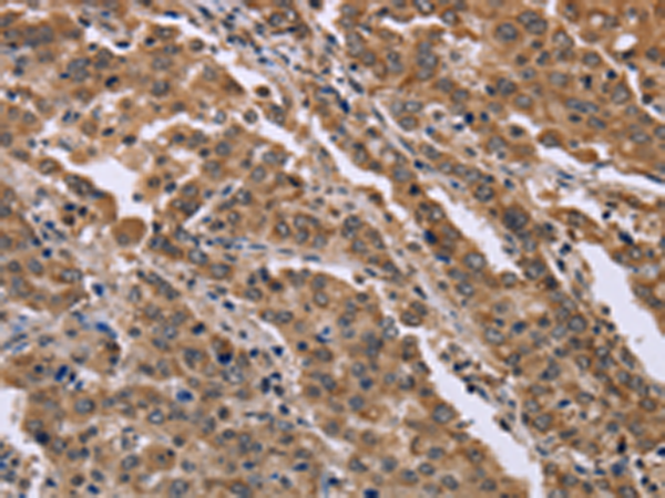 Rabbit Polyclonal Antibody to FAM3B