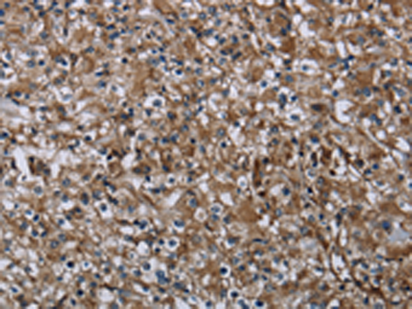 Rabbit Polyclonal Antibody to FAM89B