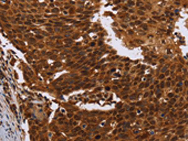 Rabbit Polyclonal Antibody to FANCF