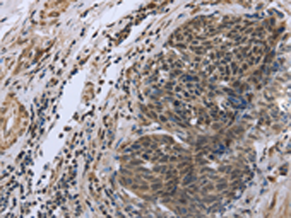 Rabbit Polyclonal Antibody to FANCG
