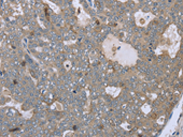 Rabbit Polyclonal Antibody to FAR2