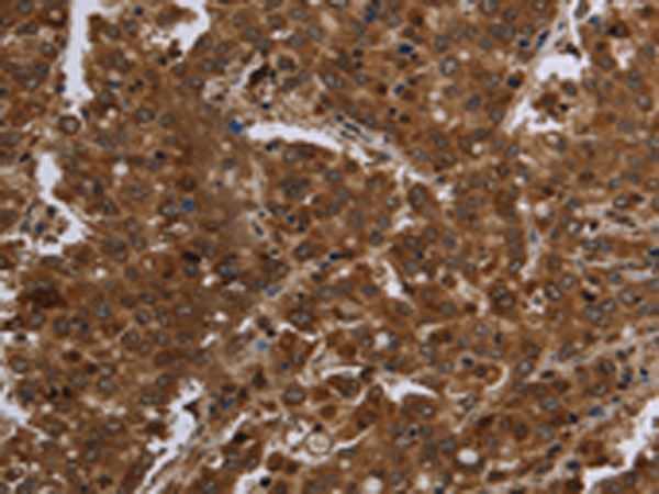 Rabbit Polyclonal Antibody to FASTKD1