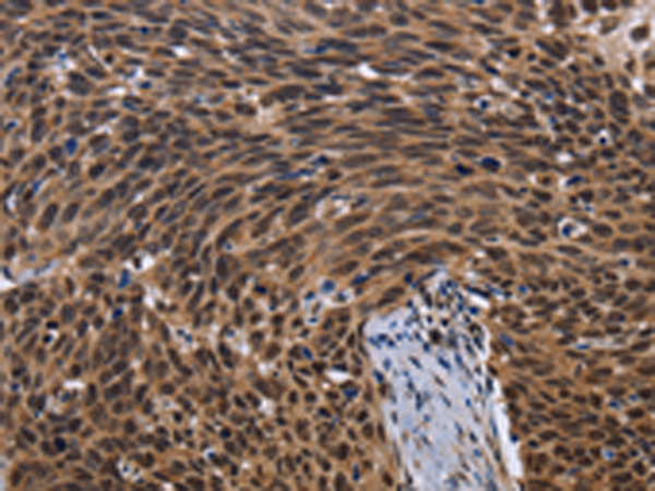 Rabbit Polyclonal Antibody to FASTKD5