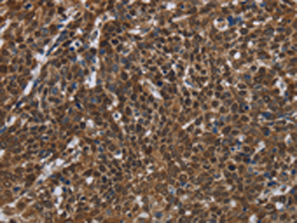 Rabbit Polyclonal Antibody to FASTKD2