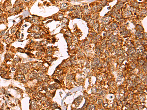 Rabbit Polyclonal Antibody to FASTKD3