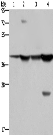 Rabbit Polyclonal Antibody to FBP1