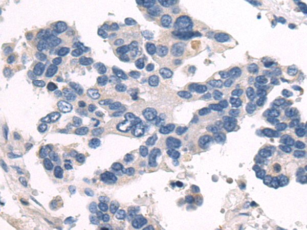 Rabbit Polyclonal Antibody to FBP2