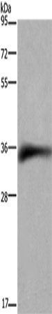 Rabbit Polyclonal Antibody to FCGR2B