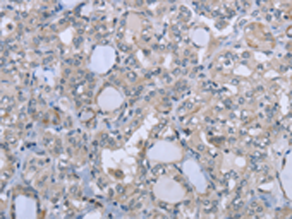 Rabbit Polyclonal Antibody to FES
