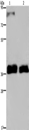 Rabbit Polyclonal Antibody to FETUB