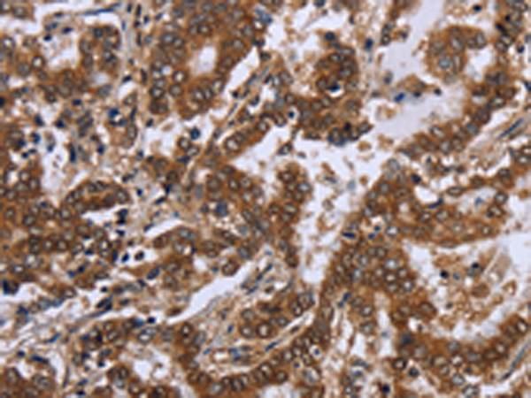 Rabbit Polyclonal Antibody to FGF21