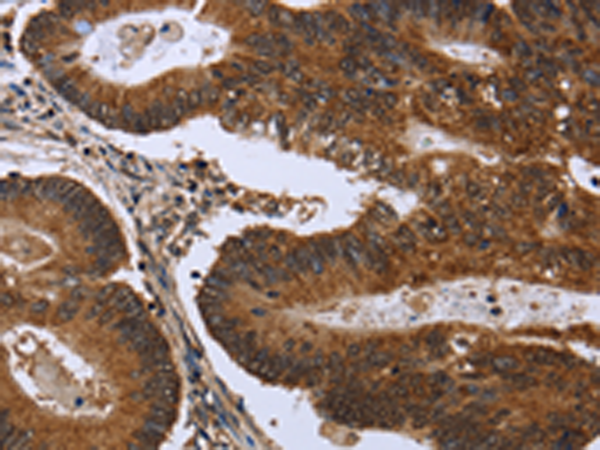 Rabbit Polyclonal Antibody to FGFR1OP