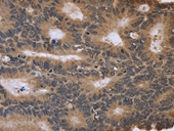 Rabbit Polyclonal Antibody to FGFR1OP2