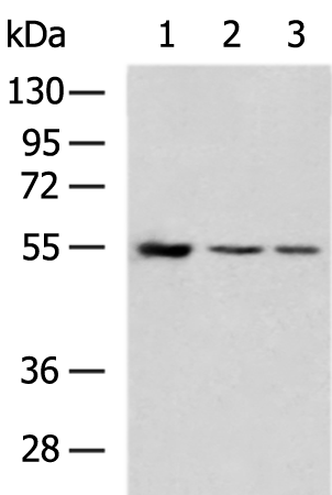 Rabbit Polyclonal Antibody to FGL2