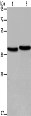 Rabbit Polyclonal Antibody to FHL1