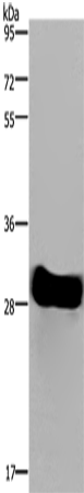 Rabbit Polyclonal Antibody to FHL2