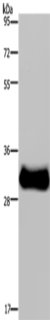 Rabbit Polyclonal Antibody to FHL3