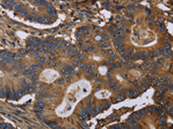 Rabbit Polyclonal Antibody to FGB