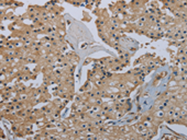 Rabbit Polyclonal Antibody to FLCN