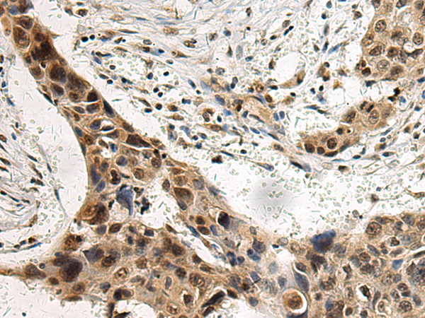 Rabbit Polyclonal Antibody to FLI1