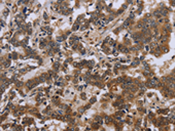 Rabbit Polyclonal Antibody to FMR1