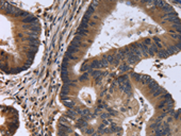 Rabbit Polyclonal Antibody to FSTL1
