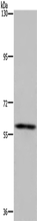 Rabbit Polyclonal Antibody to FTO