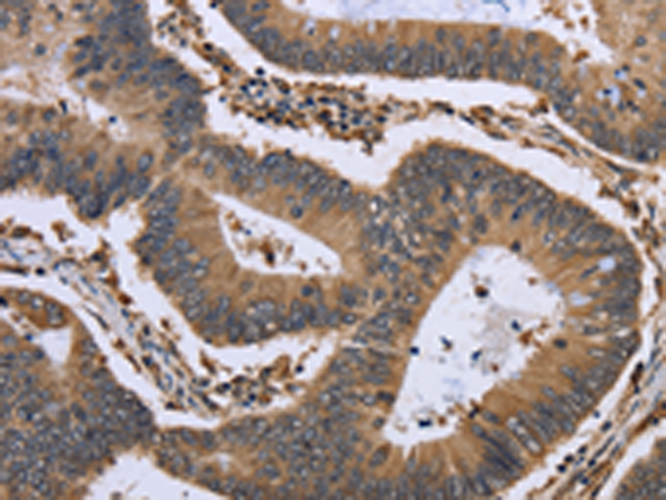 Rabbit Polyclonal Antibody to GADD45B