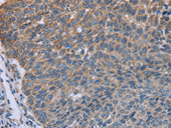 Rabbit Polyclonal Antibody to GNAI3
