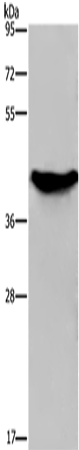 Rabbit Polyclonal Antibody to GALK1