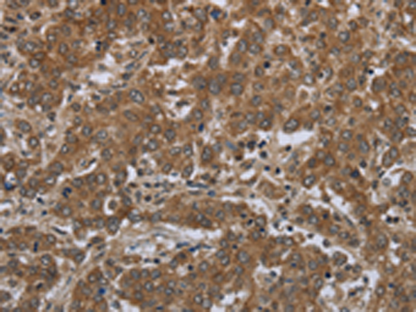 Rabbit Polyclonal Antibody to GABRB1