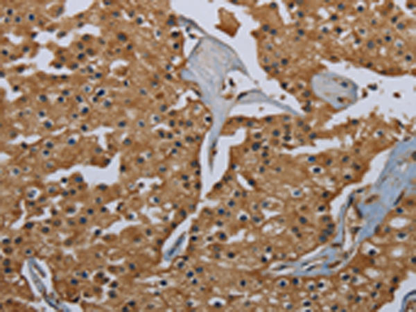 Rabbit Polyclonal Antibody to GBP5