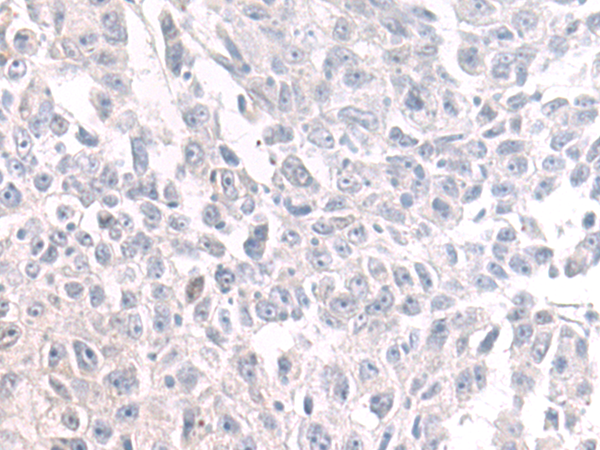 Rabbit Polyclonal Antibody to PIP