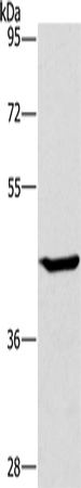 Rabbit Polyclonal Antibody to GCK