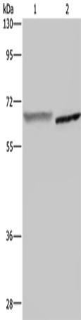 Rabbit Polyclonal Antibody to GCKR