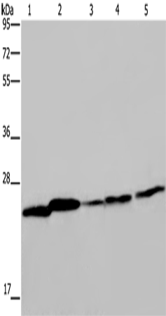 Rabbit Polyclonal Antibody to ARHGDIA