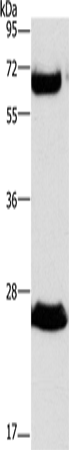 Rabbit Polyclonal Antibody to GGT1