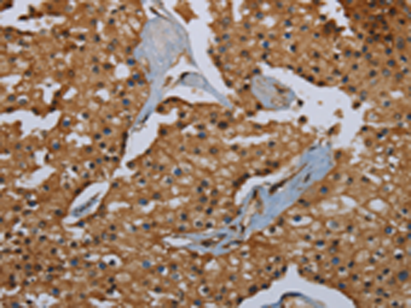 Rabbit Polyclonal Antibody to ID2