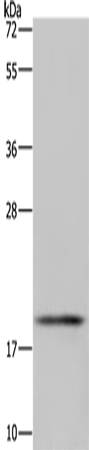 Rabbit Polyclonal Antibody to GLO1