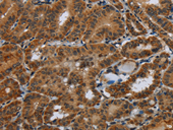Rabbit Polyclonal Antibody to NR3C1