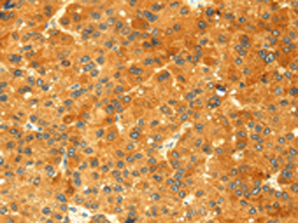 Rabbit Polyclonal Antibody to GK
