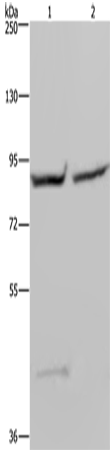 Rabbit Polyclonal Antibody to GYS1