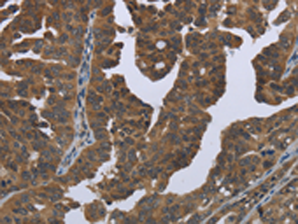 Rabbit Polyclonal Antibody to GYS2