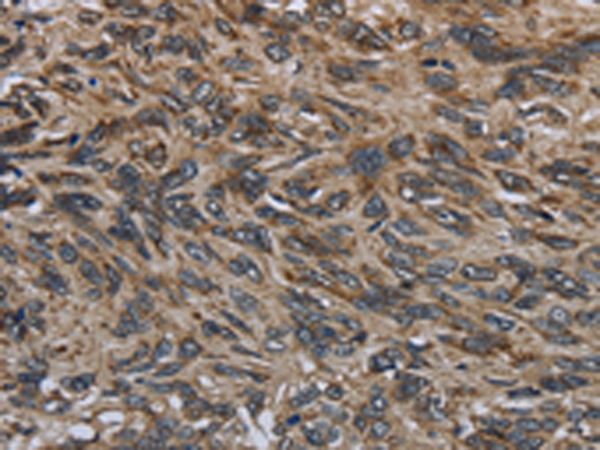 Rabbit Polyclonal Antibody to GYPC