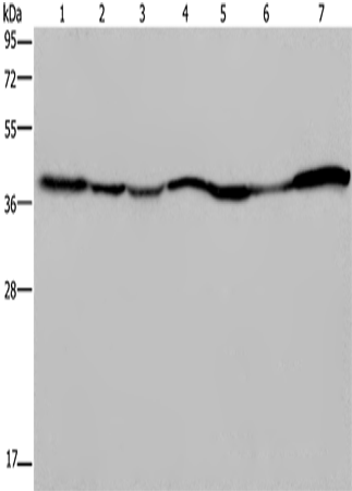 Rabbit Polyclonal Antibody to GOT2