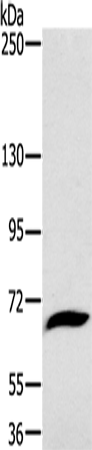 Rabbit Polyclonal Antibody to GP1BA