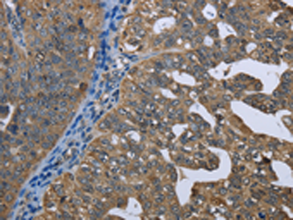 Rabbit Polyclonal Antibody to GPAM